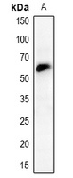CHK2 Rabbit Polyclonal Antibody