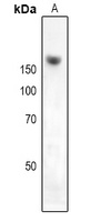 NKTR Rabbit Polyclonal Antibody