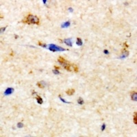 NKTR Rabbit Polyclonal Antibody