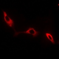 NKTR Rabbit Polyclonal Antibody