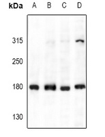 Collagen 4 Rabbit Polyclonal Antibody