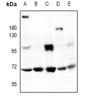 HMB45 Rabbit Polyclonal Antibody