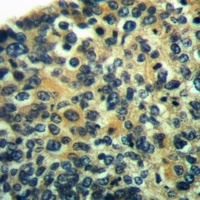 HMB45 Rabbit Polyclonal Antibody