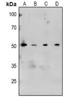 CaMK2 alpha/beta/delta (Phospho-T305) Rabbit Polyclonal Antibody