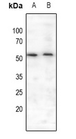 MEF2A (Phospho-S408) Rabbit Polyclonal Antibody