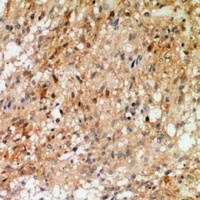 Synaptotagmin (Phospho-T202/199) Rabbit Polyclonal Antibody