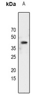 C/EBP alpha (Phospho-S21) Rabbit Polyclonal Antibody