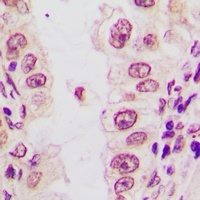 C/EBP alpha (Phospho-S21) Rabbit Polyclonal Antibody