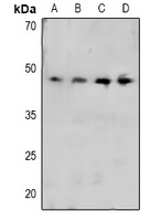 CRK (Phospho-Y221) Rabbit Polyclonal Antibody