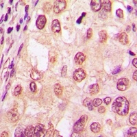 Glucocorticoid Receptor (Phospho-S226) Rabbit Polyclonal Antibody