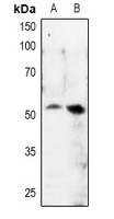 MITF (Phospho-S180) Rabbit Polyclonal Antibody