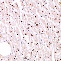 MITF (Phospho-S180) Rabbit Polyclonal Antibody