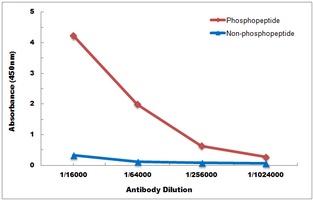 MITF (Phospho-S180) Rabbit Polyclonal Antibody