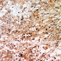 RSK1 (Phospho-T359/S363) Rabbit Polyclonal Antibody