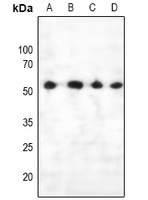 PTEN (Phospho-S385) Rabbit Polyclonal Antibody