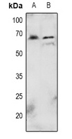 AKT (Phospho-T72) Rabbit Polyclonal Antibody