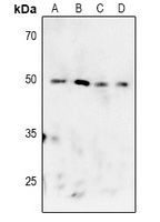 MK2 (Phospho-T222) Rabbit Polyclonal Antibody