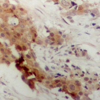 MK2 (Phospho-T222) Rabbit Polyclonal Antibody