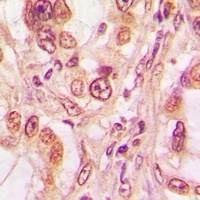 p53 (Phospho-T81) Rabbit Polyclonal Antibody