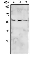 BRK (Phospho-Y447) Rabbit Polyclonal Antibody