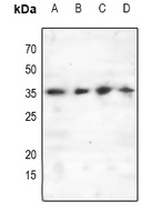 C/EBP epsilon (Phospho-T74) Rabbit Polyclonal Antibody
