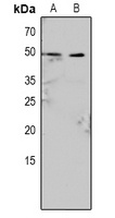 Caspase 9 (Phospho-Y153) Rabbit Polyclonal Antibody
