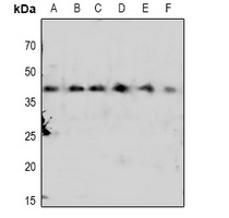 CDK7 (Phospho-T170) Rabbit Polyclonal Antibody