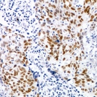 CDK7 (Phospho-T170) Rabbit Polyclonal Antibody