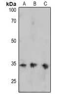 FOSB (Phospho-S27) Rabbit Polyclonal Antibody