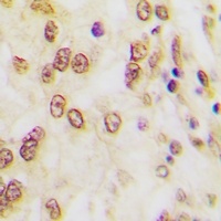 FOSB (Phospho-S27) Rabbit Polyclonal Antibody