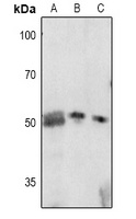 p57 Kip2 (Phospho-T310) Rabbit Polyclonal Antibody