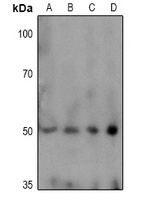 TPH1 (Phospho-S58) Rabbit Polyclonal Antibody