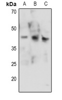 CDK9 (Phospho-T186) Rabbit Polyclonal Antibody