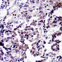 CDK9 (Phospho-T186) Rabbit Polyclonal Antibody