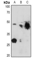 Kir6.2 (Phospho-T224) Rabbit Polyclonal Antibody
