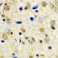 Kir6.2 (Phospho-T224) Rabbit Polyclonal Antibody