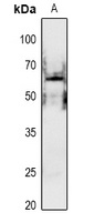 PAK1 (Phospho-S199) Rabbit Polyclonal Antibody