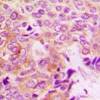 PAK1 (Phospho-S199) Rabbit Polyclonal Antibody