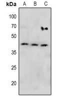 MKK4 (Phospho-S257) Rabbit Polyclonal Antibody