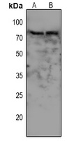 WEE1 (Phospho-S642) Rabbit Polyclonal Antibody