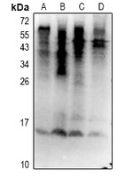 Ubiquitin (Phospho-S65) Rabbit Polyclonal Antibody