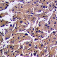 PINK1 (Phospho-S228) Rabbit Polyclonal Antibody