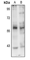 PINK1 (Phospho-S402) Rabbit Polyclonal Antibody