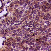 PINK1 (Phospho-S402) Rabbit Polyclonal Antibody