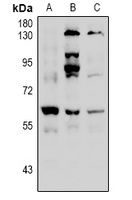 Histone Deacetylase 2 (Phospho-S394) Rabbit Polyclonal Antibody