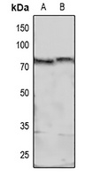 MARCKS (Phospho-S158) Rabbit Polyclonal Antibody