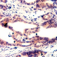 MARCKS (Phospho-S158) Rabbit Polyclonal Antibody