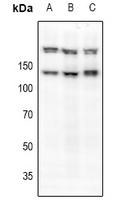 c-Met (Phospho-S985) Rabbit Polyclonal Antibody