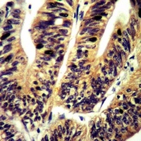 c-Met (Phospho-S985) Rabbit Polyclonal Antibody