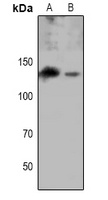 EPHA8 (Phospho-Y615) Rabbit Polyclonal Antibody